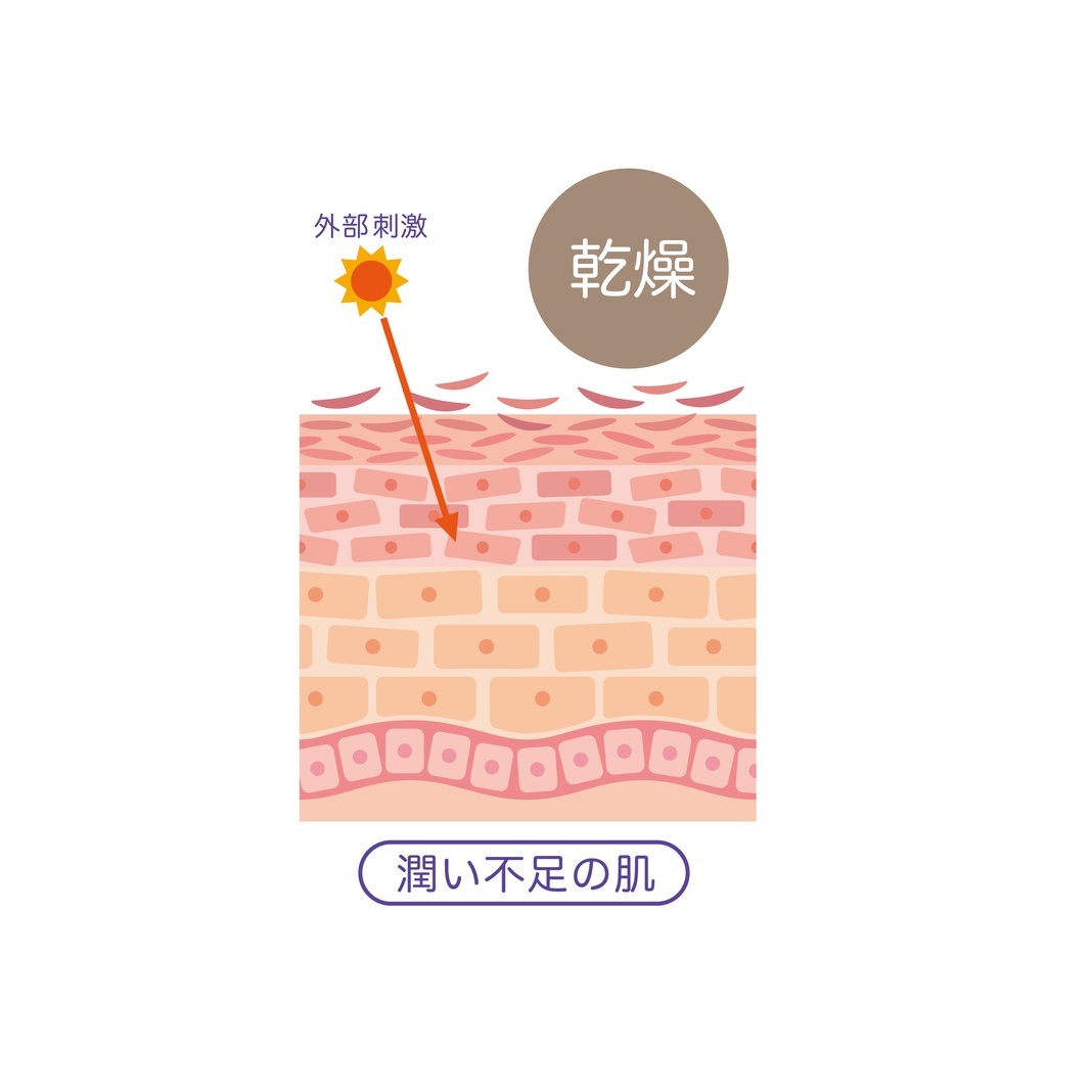 べんぴ・ぽっこりお腹が気になる